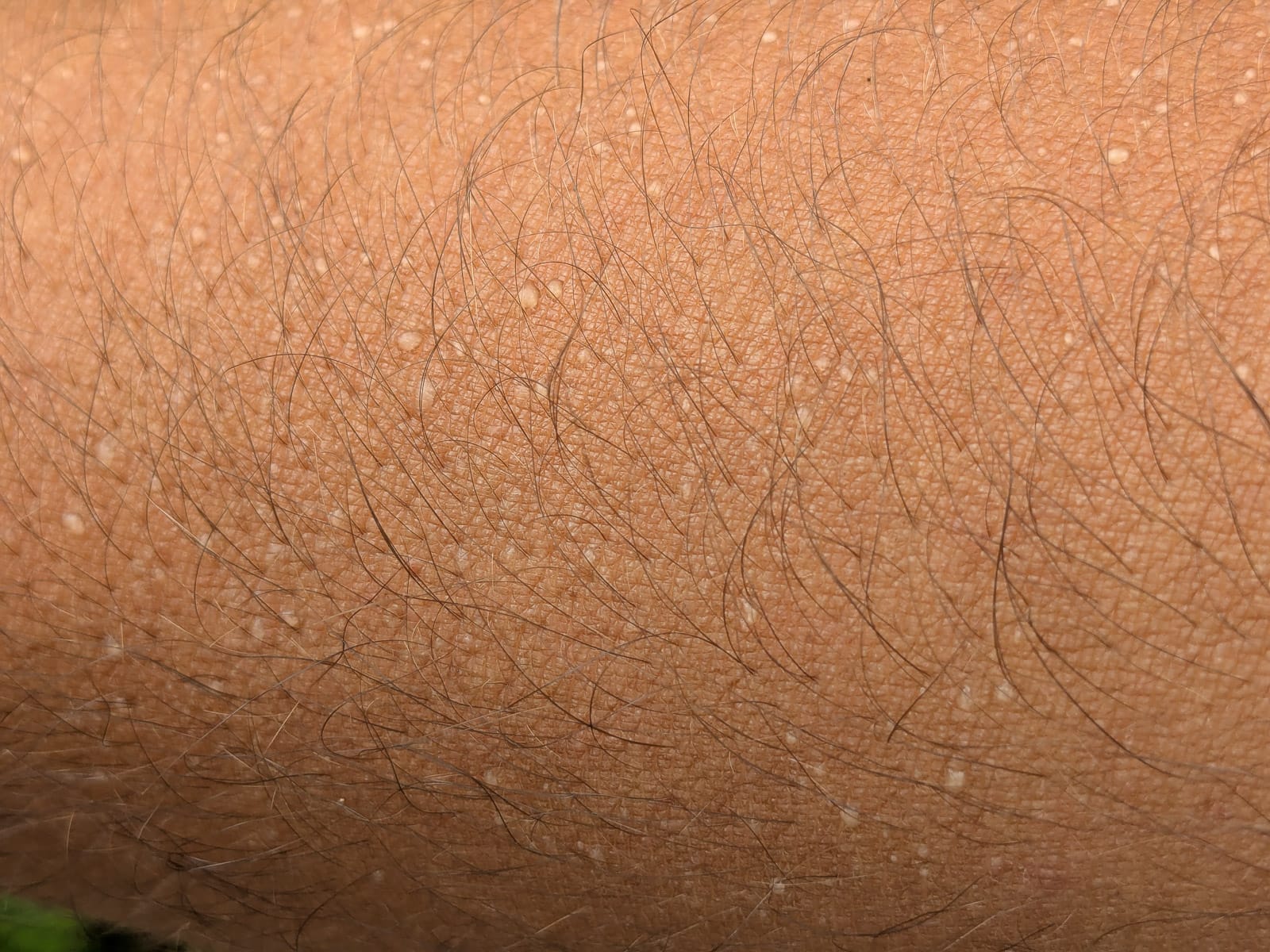 Hóvihar és magyarellenesség a déli hegyekben