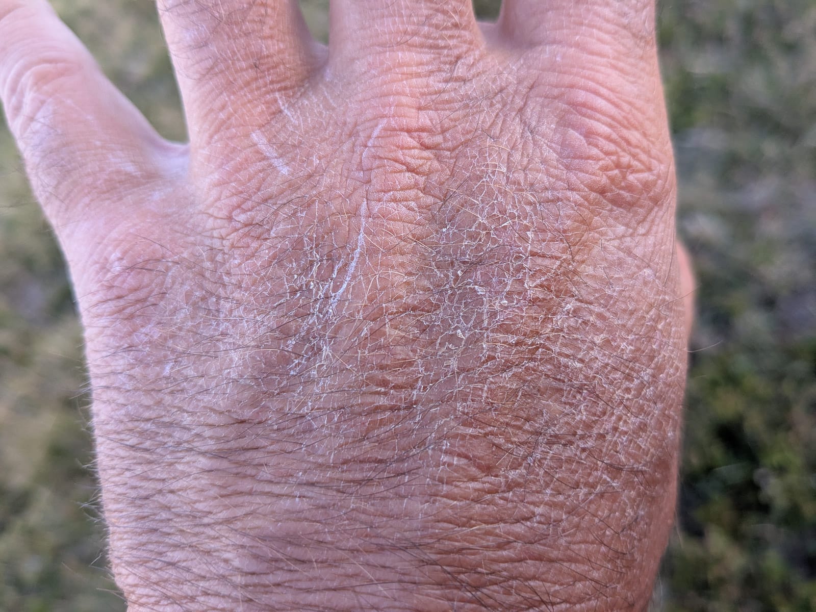 Hóvihar és magyarellenesség a déli hegyekben