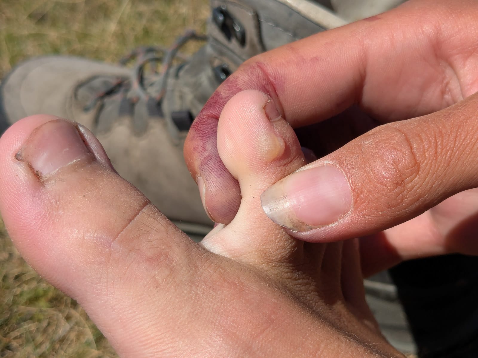 Hóvihar és magyarellenesség a déli hegyekben