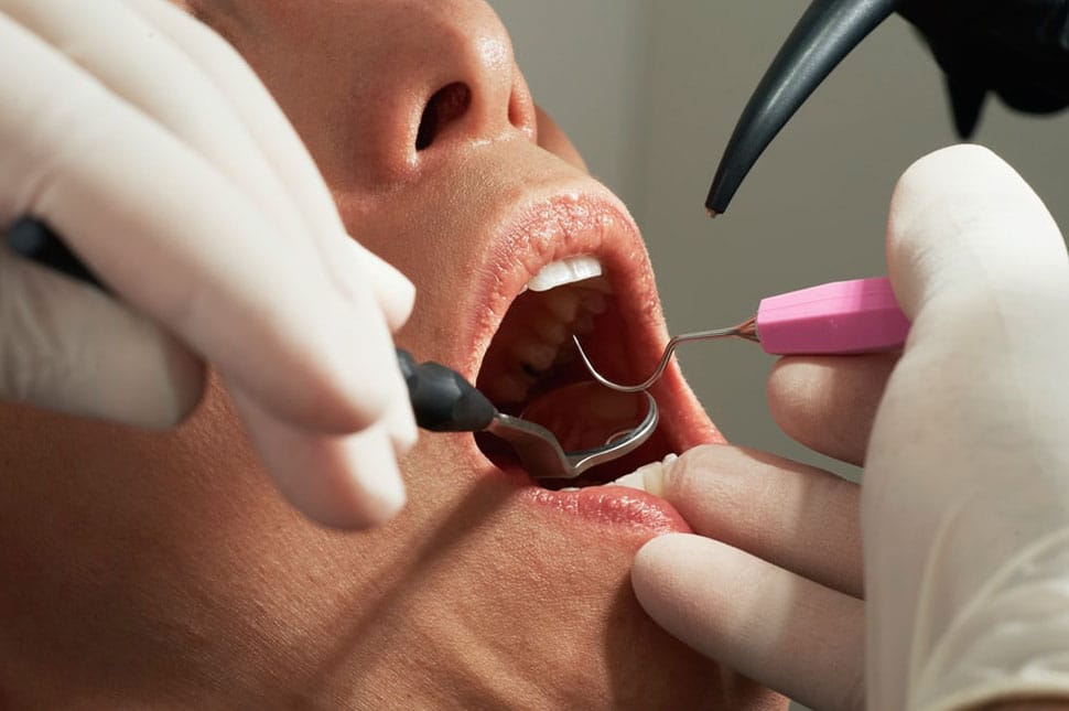 Fogorvosi ügyelet a hétvégén